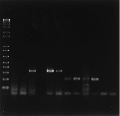Kibenge et al.: ISA virus and togavirus-like virus in Atlantic salmon 13 M 1 2 3 4 5 6 7 8 9 10 11 12 330 bp 220 bp Fig. 1. Agarose gel electrophoresis of RT-PCR products from CHSE-214 and SHK-1 cells infected with ISAV and/or togavirus-like virus.