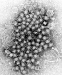 HCV (Hepatitis C Virus) Hepatitis C is a liver infectin caused by the Hepatitis C virus (HCV). HCV is a bldbrne virus.