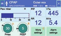 Adjusting 1 Adjust the following parameters using the therapy controls: A Maximum airway pressure Pmax B Positive end-expiratory pressure PEEP 2 Press the More settings button (C) and adjust the