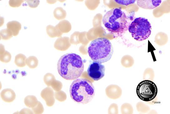 BCP-27 Blood Cell Identification Ungraded Basophil, any stage 69 97.2 4977 96.9 Educational Eosinophil, any stage 1 1.4 69 1.3 Educational Lymphocyte 1 1.
