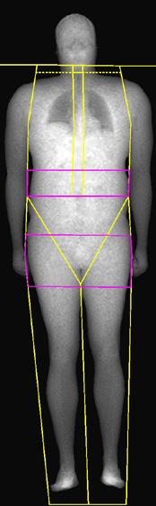 PERFORMANCE DEXA Body Composition Analysis Post-scan Information for Patients What measurements do I receive and what do they mean?