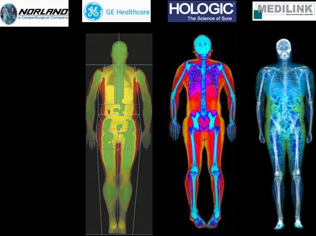 PERFORMANCE DEXA Image Composition Comparison Chart Why choose Medilink?