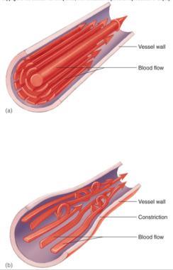 Osmotic pressure in interstitial fluid pulls fluid out of capillary.