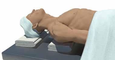 Exposure ANTERIOR APPROACH Patient Positioning Patient positioning on the operating table is dependent on the level(s) to be operated.