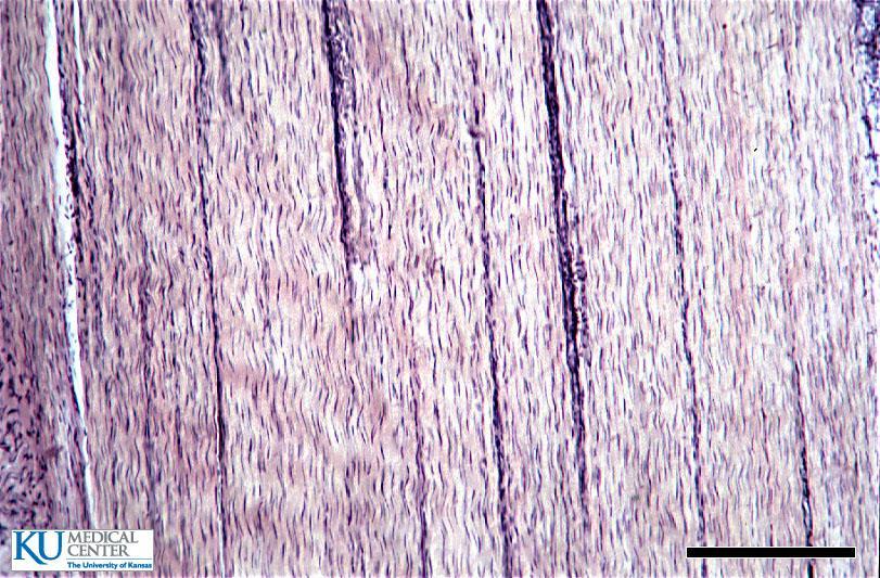 DENSE CT (3) 1. DRCT : composed of mainly collagen fibers in an orderly pattern or paralleled (non-living significance???) with many fibroblasts present.