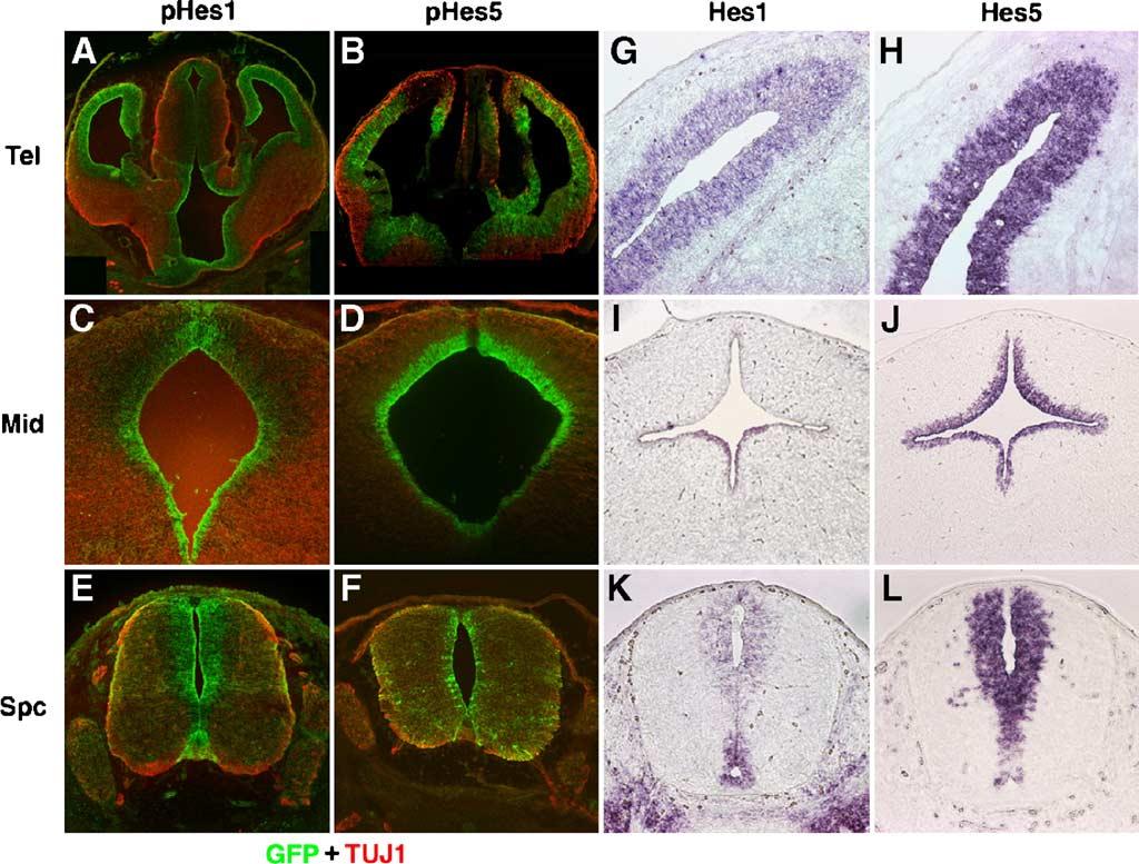 T. Ohtsuka et al. / Mol. Cell. Neurosci. 31 (2006) 109 122 111 identical patterns of GFP expression in all tissues examined, with the exception of one line of phes5-d2egfp mice.