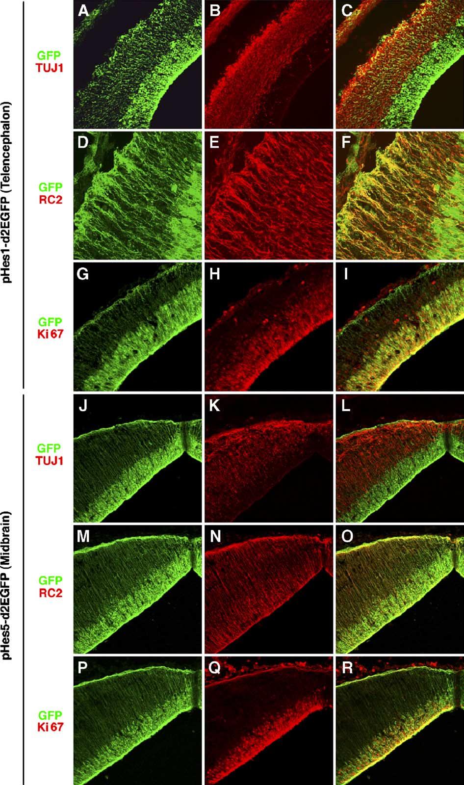 T. Ohtsuka et al. / Mol. Cell. Neurosci. 31 (2006) 109 122 113 Fig. 3. GFP is expressed by mitotically active VZ cells, including radial glia.
