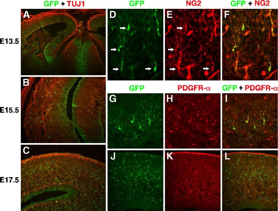 114 T. Ohtsuka et al. / Mol. Cell. Neurosci. 31 (2006) 109 122 Fig. 4. GFP expression in oligodendrocyte precursor cells in the telencephalon of phes5 Tg mice.