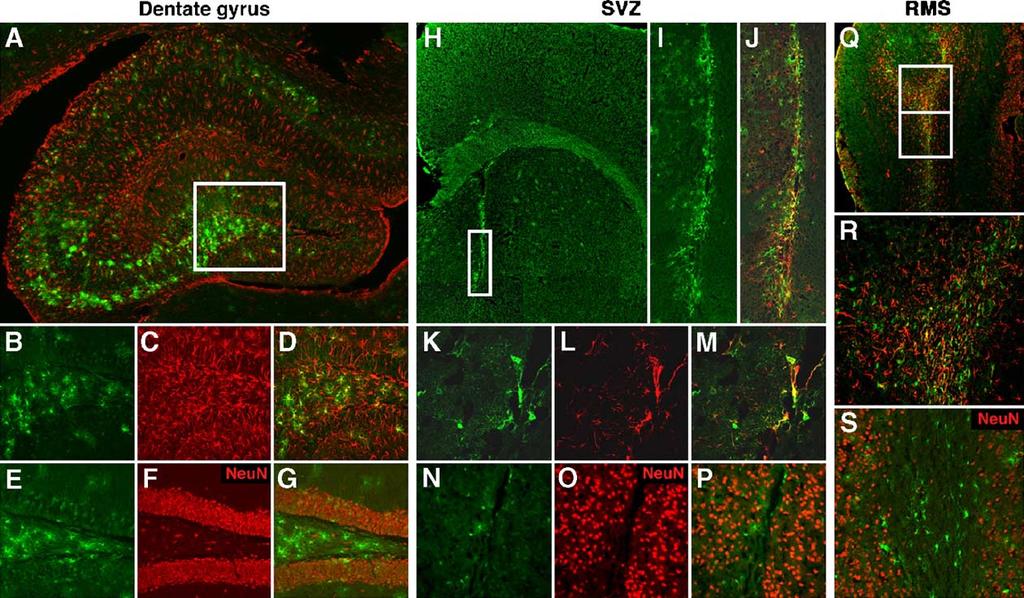T. Ohtsuka et al. / Mol. Cell. Neurosci. 31 (2006) 109 122 115 Fig. 5. GFP expression in the brains of adult phes1 Tg mice.