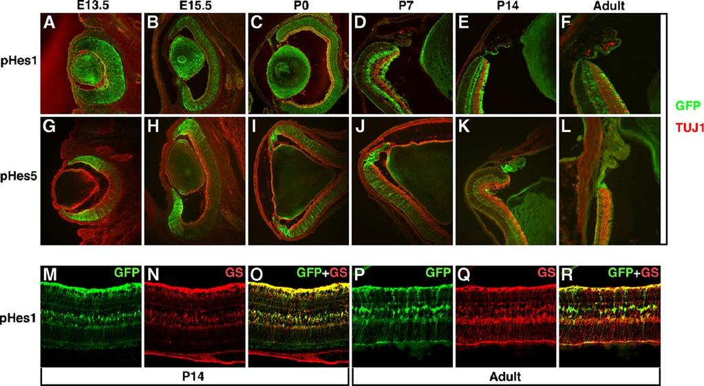 116 T. Ohtsuka et al. / Mol. Cell. Neurosci. 31 (2006) 109 122 Fig. 6. GFP expression in the retinas of phes1 and phes5 Tg mice.