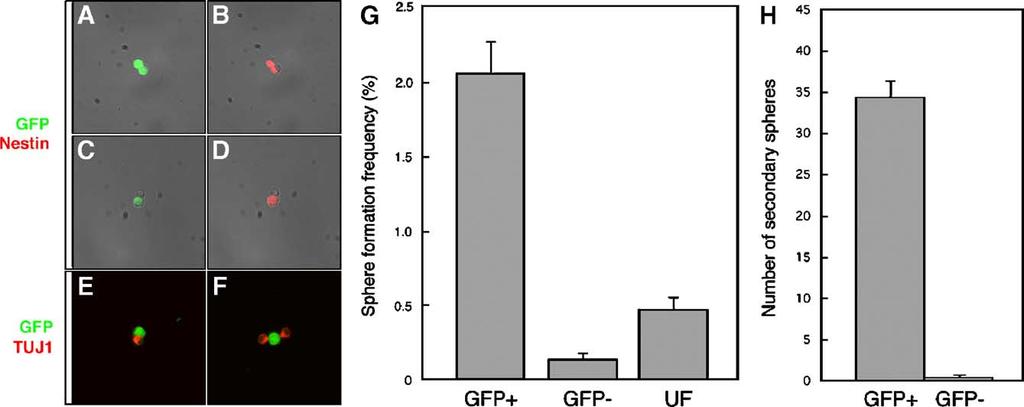 5, GFP expression was apparent in the central retina of phes1 Tg animals but was less strong in the periphery, whereas GFP expression was higher in the peripheral retina in phes5 Tg mice (G, H).