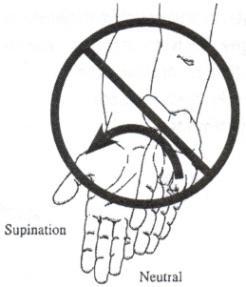 Post Surgical Precautions Do not actively bend your elbow Do not actively supinate (turn your palm towards the ceiling) your forearm Do not use the injured arm for any activities until your therapist