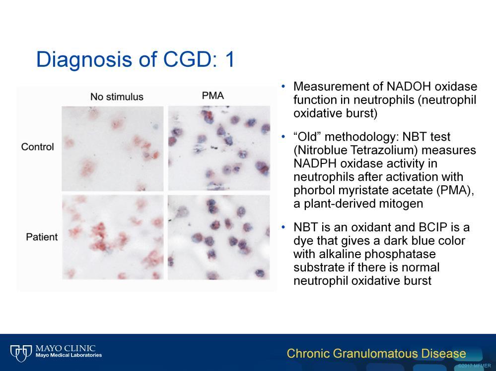 The laboratory diagnosis of CGD has traditionally involved the use of the nitroblue tetrazolium test, which is useful for measuring NADPH oxidase function in neutrophils.