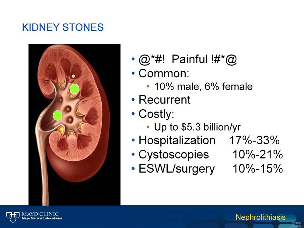 Kidney stones are abnormal crystalline deposits that grow slowly in the kidney over many months to years.