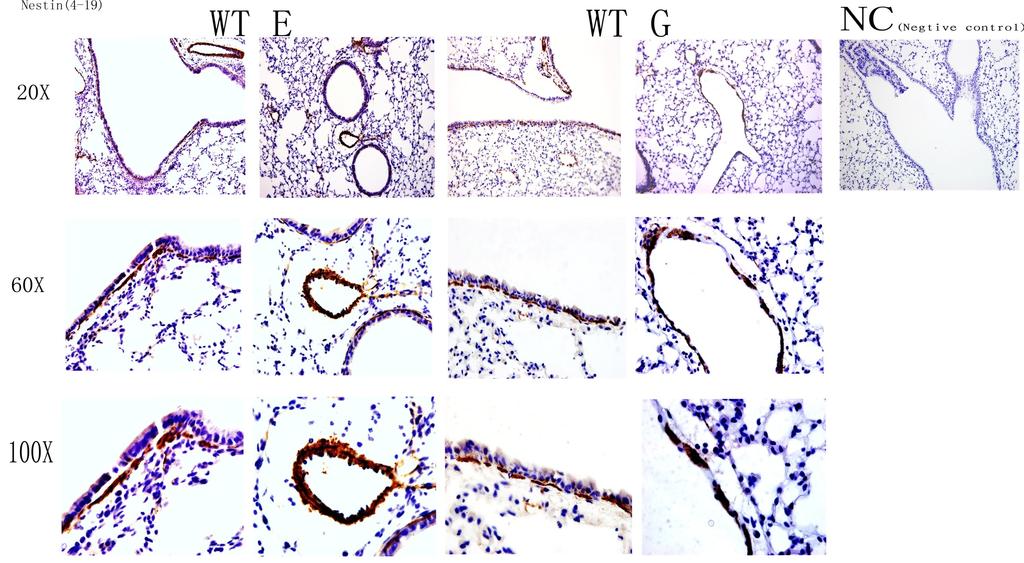 MSCs in Lungs of Cockroach Extract ()-Challenged Mice A B C A: