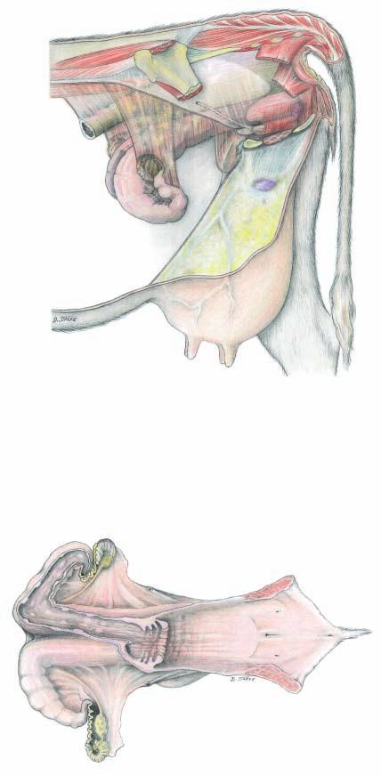 Female genital organs (Left side) 1 Suspensory lig. of the ovary Broad lig.
