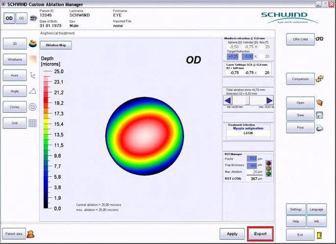 Aspheric treatment profile Based on manifest refraction (lower order aberrations) only Goal: