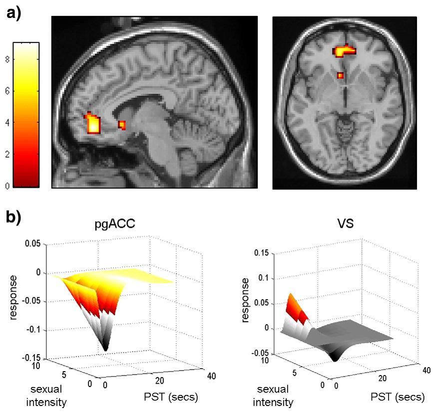 M. Walter et al. / NeuroImage 40 (2008) 1482 1494 1487 attentiveness for the main picture conditions (positive and negative bodily and non-bodily-emotional pictures) could thus be ruled out.