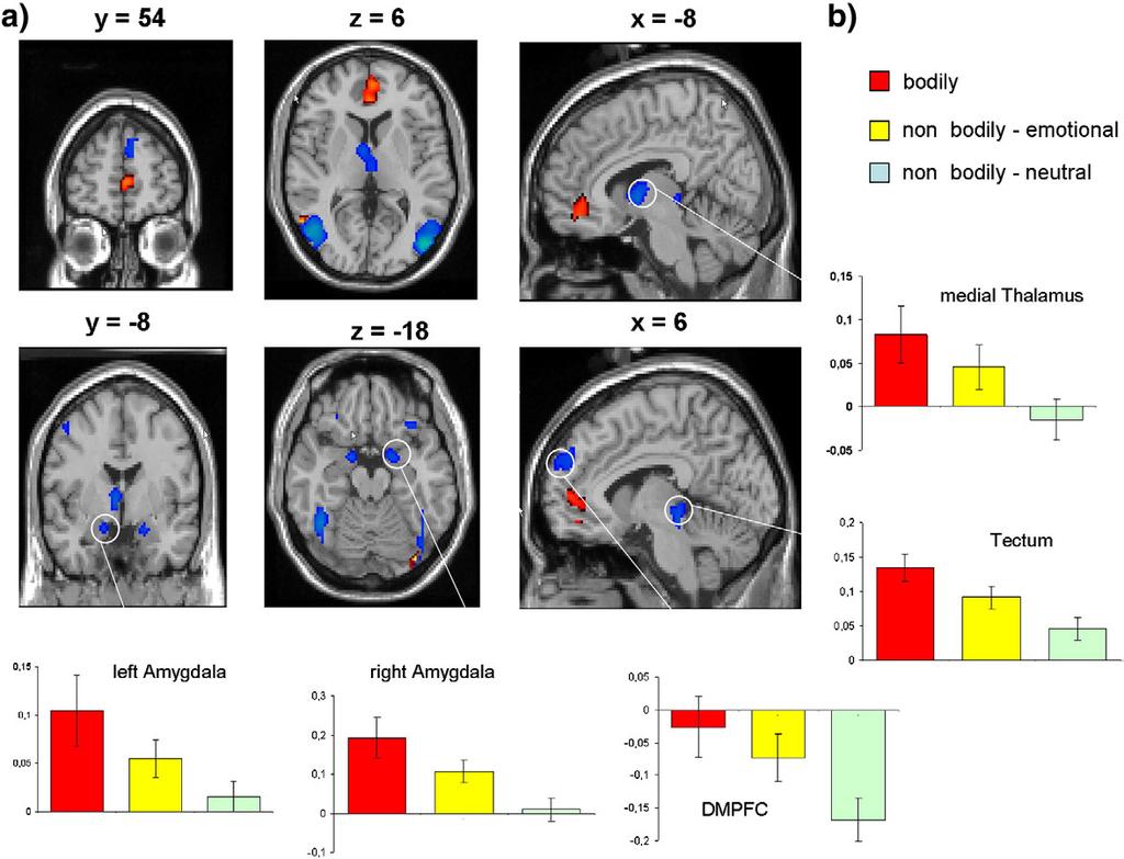 M. Walter et al. / NeuroImage 40 (2008) 1482 1494 1489 Fig. 5. Common and interacting regions in sexual and emotional processing.
