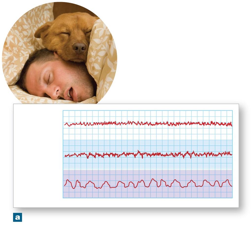 Figure 16-14a Levels of Sleep Awake REM sleep Deep (slow wave) sleep EEG from the awake, REM, and deep