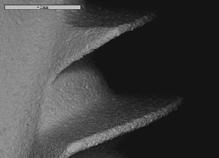 SEM images were taken from various parts of the implant, area 1 from the
