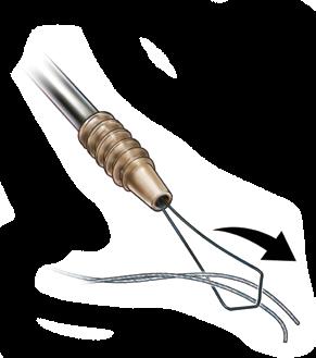 Use the Knotless ALLthread Punch to make a pilot hole in soft or intermediate bone (Figure 17). Use a Knotless ALLthread Tap to make a pilot hole in hard bone (Figure 18).