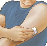 Choose a site that is at least 1 inch (2.5 cm) away from an insulin injection site.