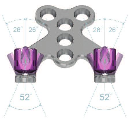 Implant Design Features Plate Body Allows five points of fixation to the occiput, three points on the midline*, and two additional points at the superior lateral end Can be contoured in the sagittal