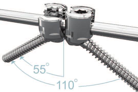 Implant Overview Polyaxial Screws One of the key features of the Biased Angle Polyaxial Screw is the offset angle of the screw head, which allows for combined divergent screw angulation of 110 (or 55