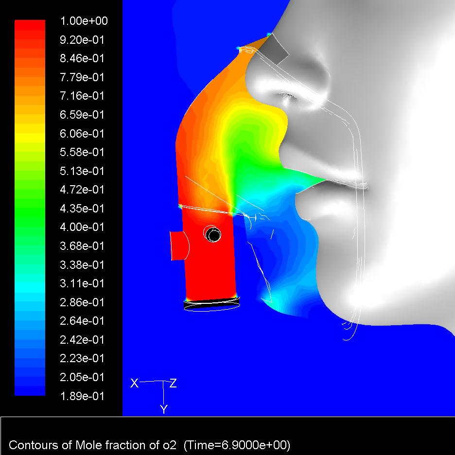 Amsino OneMask Oxygen Mask: Velocity Vectors and O2 fraction ( Peak inhalation, RF = 11 BPM, T v =