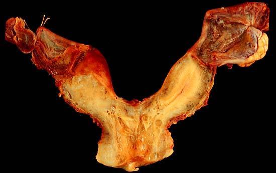 Copulatory Organs (con t) Duplex uterus Monotremes and marsupials Separated female reprod.