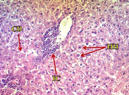 Figure (3): Liver section of 15 mg/kg cypermethrin group shows hypertrophy of hepatocytes