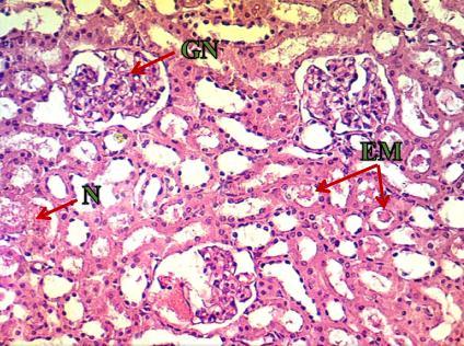 Figure (7): Kidney section of 15 mg/kg cypermethrin group shows glomeruli nephritis (GN), necrosis