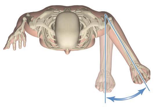 Operative technique ReUnion RSA Shoulder System In most cases, the humeral component should be set in approximately 30 of retroversion.