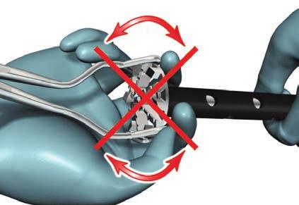by utilizing the glenoid holder to grasp around the circumference of the glenoid reamer/planar.