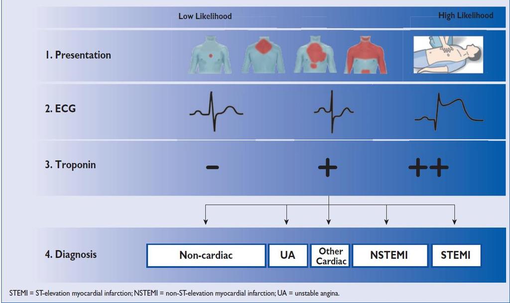 Initial assessment of patients with suspected acute coronary syndromes <10 min Emergency Echo