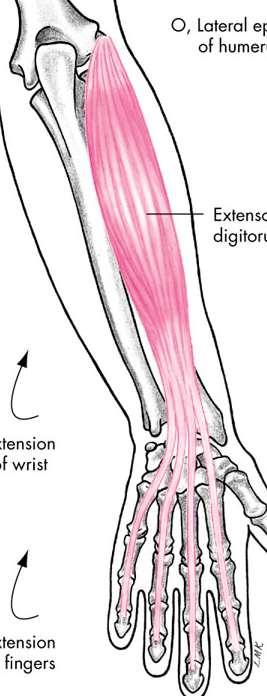 Extensor Digitorum Muscle Extensor Digitorum Origin Insertion Lateral epicondyle of the humerus-common extensor tendon By 4 tendons, each to the base of the