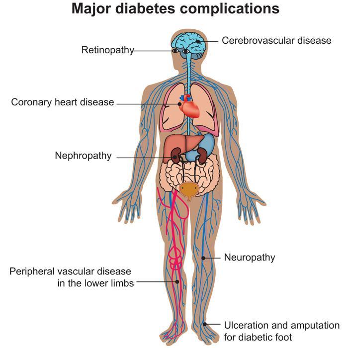 The Basics Complications High blood glucose can damage nerves and blood vessels causing heart disease, stroke, kidney problems,