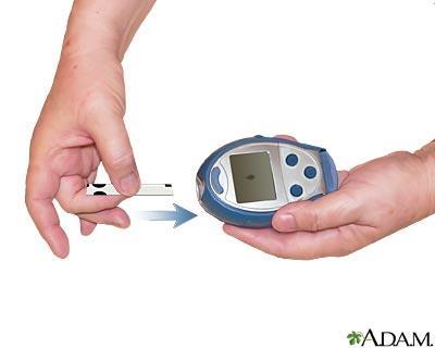 BGM Equipment Lancing device Lancets Blood glucose monitor