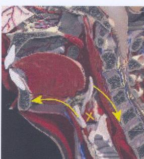 Clinical Physiology of swallowing Mechanism.docx - Page 12/14 Figure 8. Laryngeal seal [1] (e) The cricopharyngeal sphincter is opened to allow material to pass through into the esophagus.