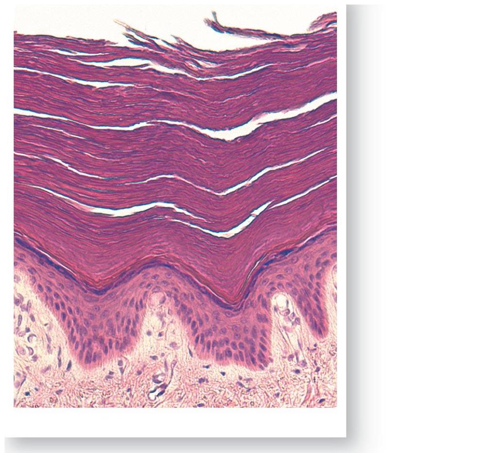 Figure 5-2 The Structure of the Epidermis.