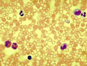 Leukocytes (White Blood Cells) Blood cells that have a nucleus and cytoplasm and help