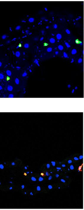 larvae) and fat body immunoblots (F and I) in Actb-overexpressing