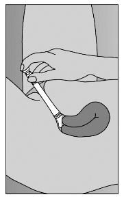 Lie on back with knees drawn up. To deliver medication, gently insert applicator deeply into vagina and press plunger downward to its original position (Figure C). Figure C Step 6.
