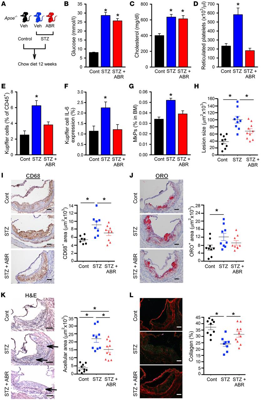 Figure 8. Blocking S100A8/ A9 with ABR-215757 decreases atherogenesis in diabetic mice.
