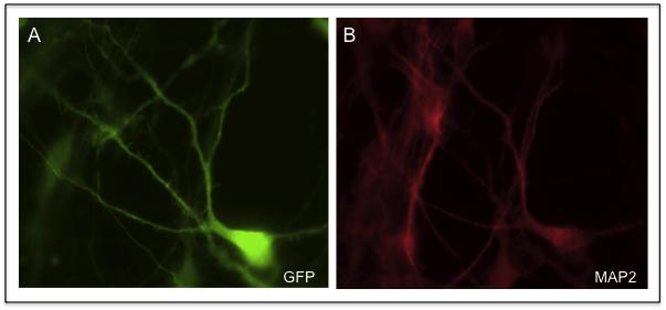 Fig. 3. PLL3.7- Day 62 infection. (A) GFP staining of an isolated neuron showing the presence of dendritic spines. (B) MAP2 staining to confirm neuronal identity.