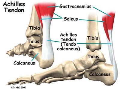 They are also common among both active and sedentary (inactive) middle-aged adults. These problems cause pain at the back of the calf.