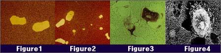- 2 - - Figure 1, 2: Resorption areas in a culture dish after removing osteoclasts - Figure 3: TRAP staining of osteoclasts in situ culture dish and resorption area - Figure 4: SEM picture of an