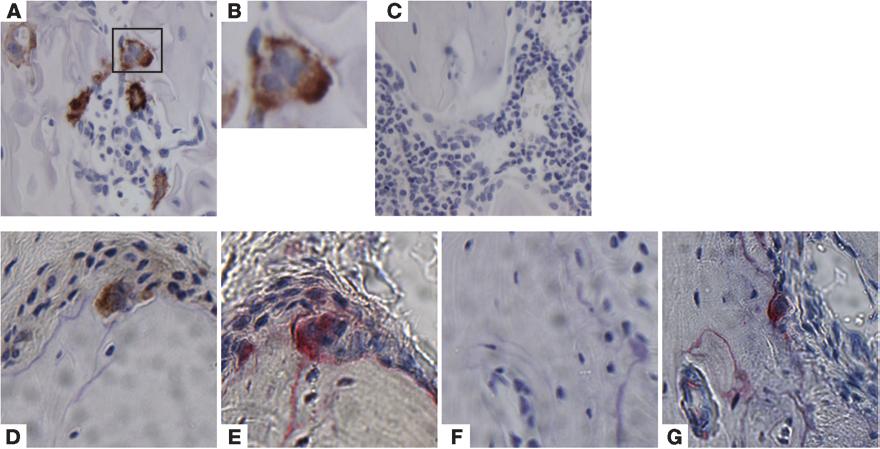 Figure 5 BM CD11b /lo Ly6C hi CD117 + OCPs differentiate into osteoclasts in vivo.