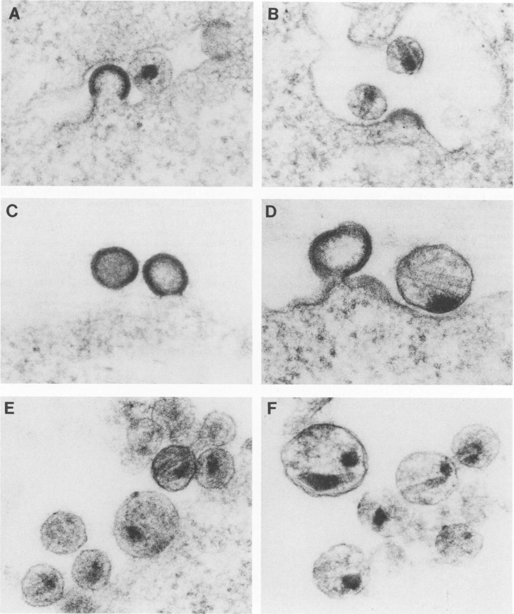 VOL. 64, 1990 NOTES 5233 A B;'..-.....A ;r"la "A..4.. I C D E F :7 I. I A.i FIG. 5. Electron micrographs of wild-type and mutant viral particles. (A and B) Infection with wild-type virus.